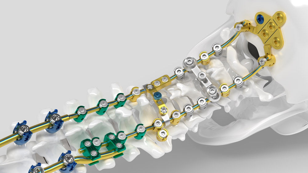 Ennovate® Cervical Chirurgiemodul