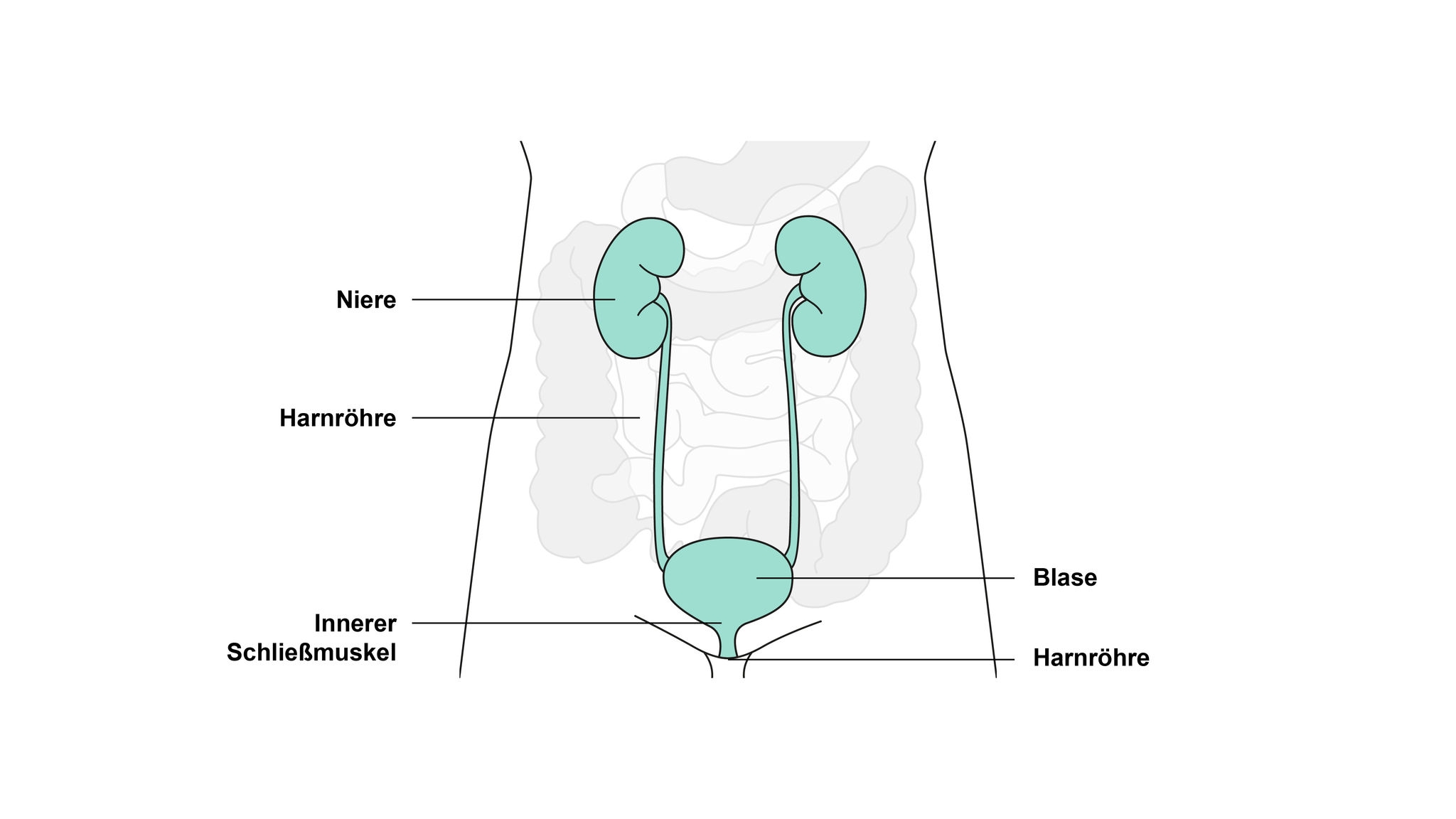 Abbildung Urostomie