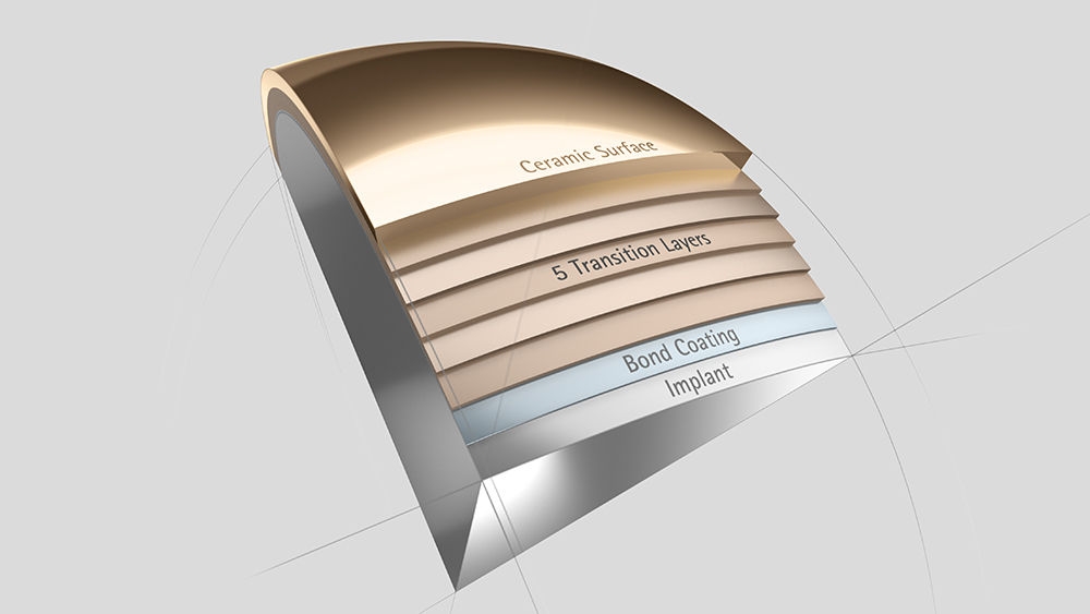 AS Advanced Surface – Multilayer-Beschichtung für Knieendoprothetik