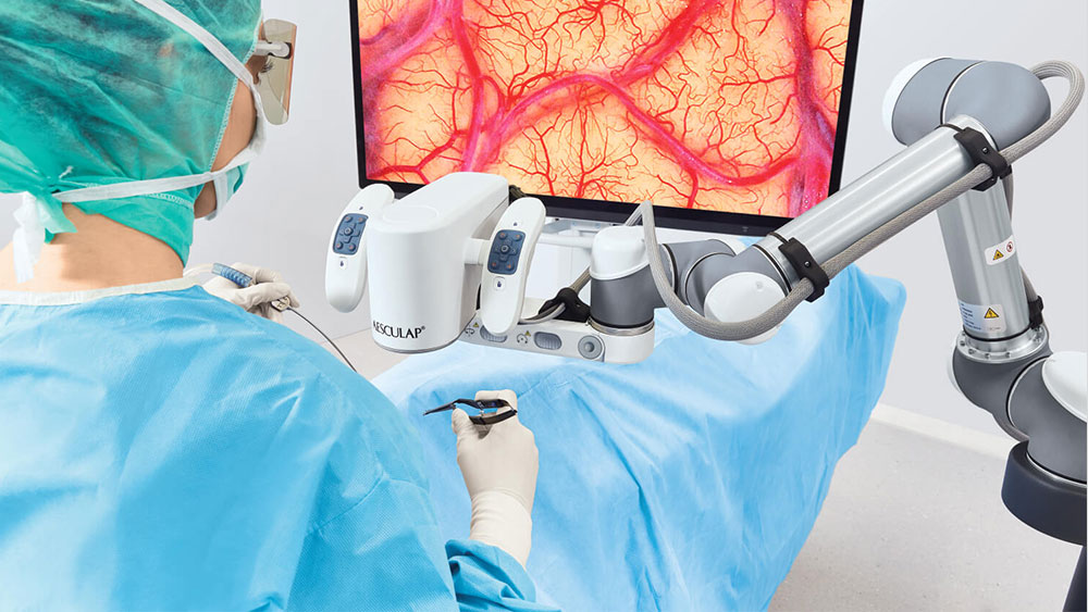 Ein Chirurg führt eine Operation mit dem Aesculap Aeos® durch, während er hochsteht und auf den Monitor schaut. 