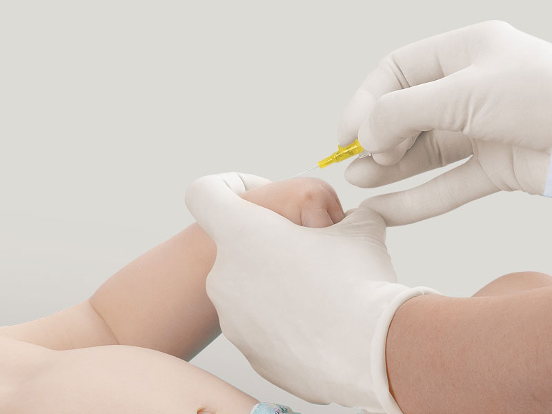 Infusionszugang über die Hand des Babys