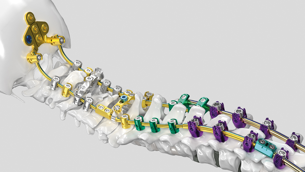 Ennovate® Cervical