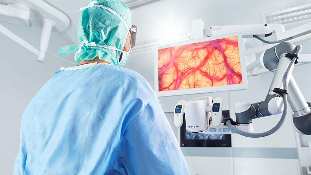 Ein Chirurg führt mit dem Aesculap Aeos® eine Neurochirurgie durch, während er hochsteht und auf den Monitor schaut. 